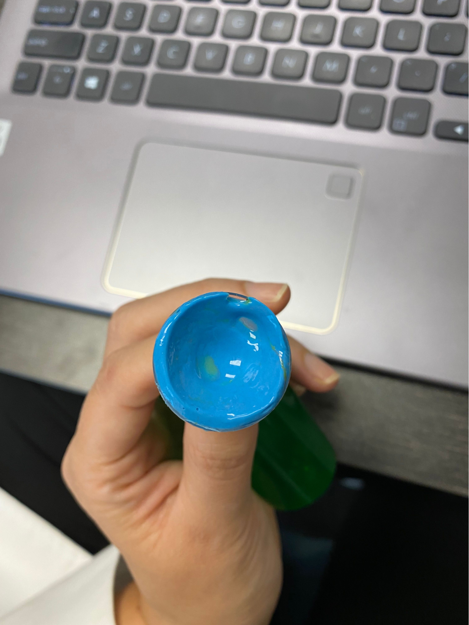 scleral lenses and how its molded to the eye